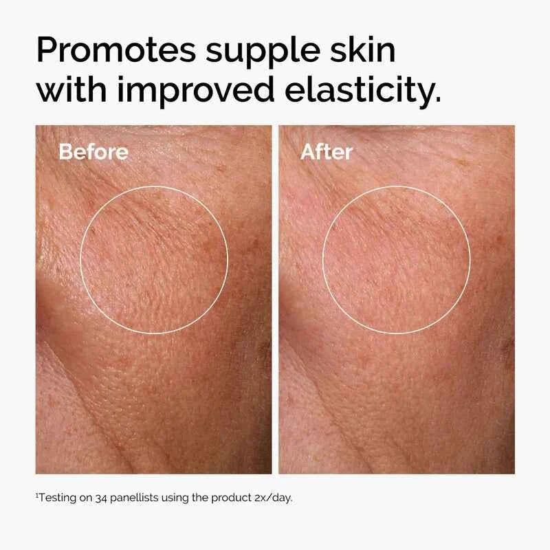 The Ordinary Hyaluronic Acid 2% + B5 (with Ceramides) – New & Improved Formula - Glow By Anie